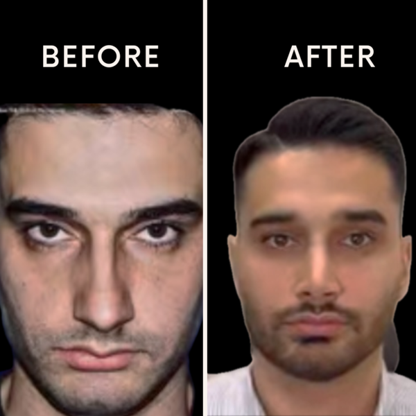 نمونه کار دکتر آرش شرفیان